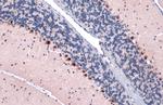 GLI1 Antibody in Immunohistochemistry (Paraffin) (IHC (P))