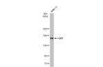 GLI1 Antibody in Western Blot (WB)