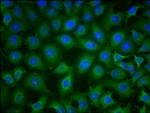 PKM Antibody in Immunocytochemistry (ICC/IF)