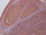 PKM Antibody in Immunohistochemistry (Paraffin) (IHC (P))