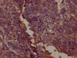 PKM Antibody in Immunohistochemistry (Paraffin) (IHC (P))