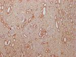 PKM Antibody in Immunohistochemistry (Paraffin) (IHC (P))