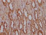 PKM Antibody in Immunohistochemistry (Paraffin) (IHC (P))