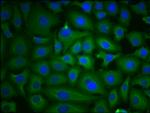 PKM Antibody in Immunocytochemistry (ICC/IF)