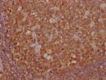 PKM Antibody in Immunohistochemistry (Paraffin) (IHC (P))