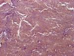 PKM Antibody in Immunohistochemistry (Paraffin) (IHC (P))