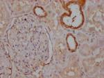 PKM Antibody in Immunohistochemistry (Paraffin) (IHC (P))