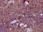 PKM Antibody in Immunohistochemistry (Paraffin) (IHC (P))