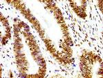 Histone H3 Antibody in Immunohistochemistry (Paraffin) (IHC (P))