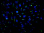 ROCK2 Antibody in Immunocytochemistry (ICC/IF)