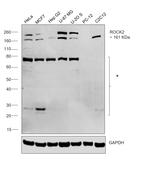 ROCK2 Antibody in Western Blot (WB)