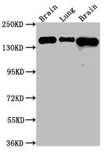 FGFR2 Antibody in Western Blot (WB)