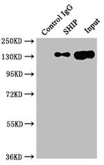 SHIP1 Antibody in Immunoprecipitation (IP)