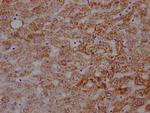 ATP5A1 Antibody in Immunohistochemistry (Paraffin) (IHC (P))