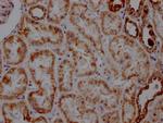 ATP5A1 Antibody in Immunohistochemistry (Paraffin) (IHC (P))