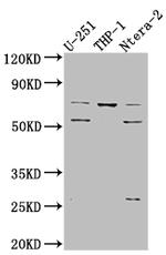 PTH1R Antibody in Western Blot (WB)