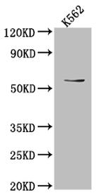 UAP1 Antibody in Western Blot (WB)