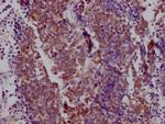 Nkx2.1 Antibody in Immunohistochemistry (Paraffin) (IHC (P))