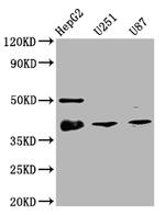 Nkx2.1 Antibody in Western Blot (WB)