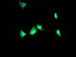 VCP Antibody in Immunocytochemistry (ICC/IF)