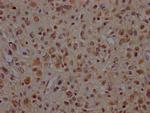 VCP Antibody in Immunohistochemistry (Paraffin) (IHC (P))