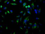 USP7 Antibody in Immunocytochemistry (ICC/IF)