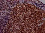 USP7 Antibody in Immunohistochemistry (Paraffin) (IHC (P))