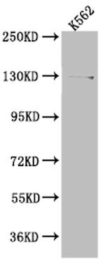 USP7 Antibody in Western Blot (WB)