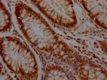 KLF4 Antibody in Immunohistochemistry (Paraffin) (IHC (P))