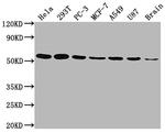 KLF4 Antibody in Western Blot (WB)