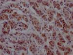 GATA3 Antibody in Immunohistochemistry (Paraffin) (IHC (P))