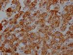 ATP Synthase beta Antibody in Immunohistochemistry (Paraffin) (IHC (P))