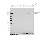 Androgen Receptor Antibody in Western Blot (WB)