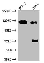 Androgen Receptor Antibody in Western Blot (WB)