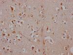 ADORA1 Antibody in Immunohistochemistry (Paraffin) (IHC (P))