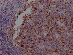 Aurora B Antibody in Immunohistochemistry (Paraffin) (IHC (P))