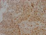 Aurora B Antibody in Immunohistochemistry (Paraffin) (IHC (P))