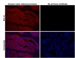 Bcl-xL Antibody in Immunohistochemistry (Paraffin) (IHC (P))