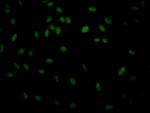 IKK beta Antibody in Immunocytochemistry (ICC/IF)