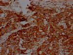 IKK beta Antibody in Immunohistochemistry (Paraffin) (IHC (P))