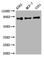 IKK beta Antibody in Western Blot (WB)