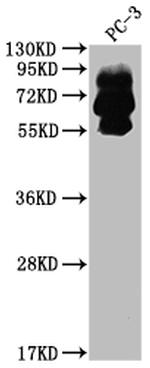 PCSK9 Antibody in Western Blot (WB)