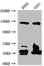 BUBR1 Antibody in Western Blot (WB)