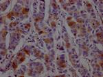 DHFR Antibody in Immunohistochemistry (Paraffin) (IHC (P))