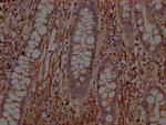 PTP1B Antibody in Immunohistochemistry (Paraffin) (IHC (P))