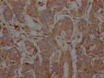 PTP1B Antibody in Immunohistochemistry (Paraffin) (IHC (P))