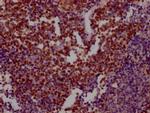 Ku80 Antibody in Immunohistochemistry (Paraffin) (IHC (P))