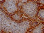 CD51 Antibody in Immunohistochemistry (Paraffin) (IHC (P))