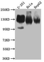 CD51 Antibody in Western Blot (WB)