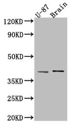 NGF Antibody in Western Blot (WB)